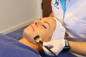 Behandelingen Chemische Peeling